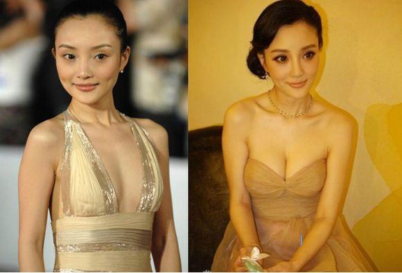 为什么明星都取出隆胸假体，揭秘明星隆胸假体取出背后的原因